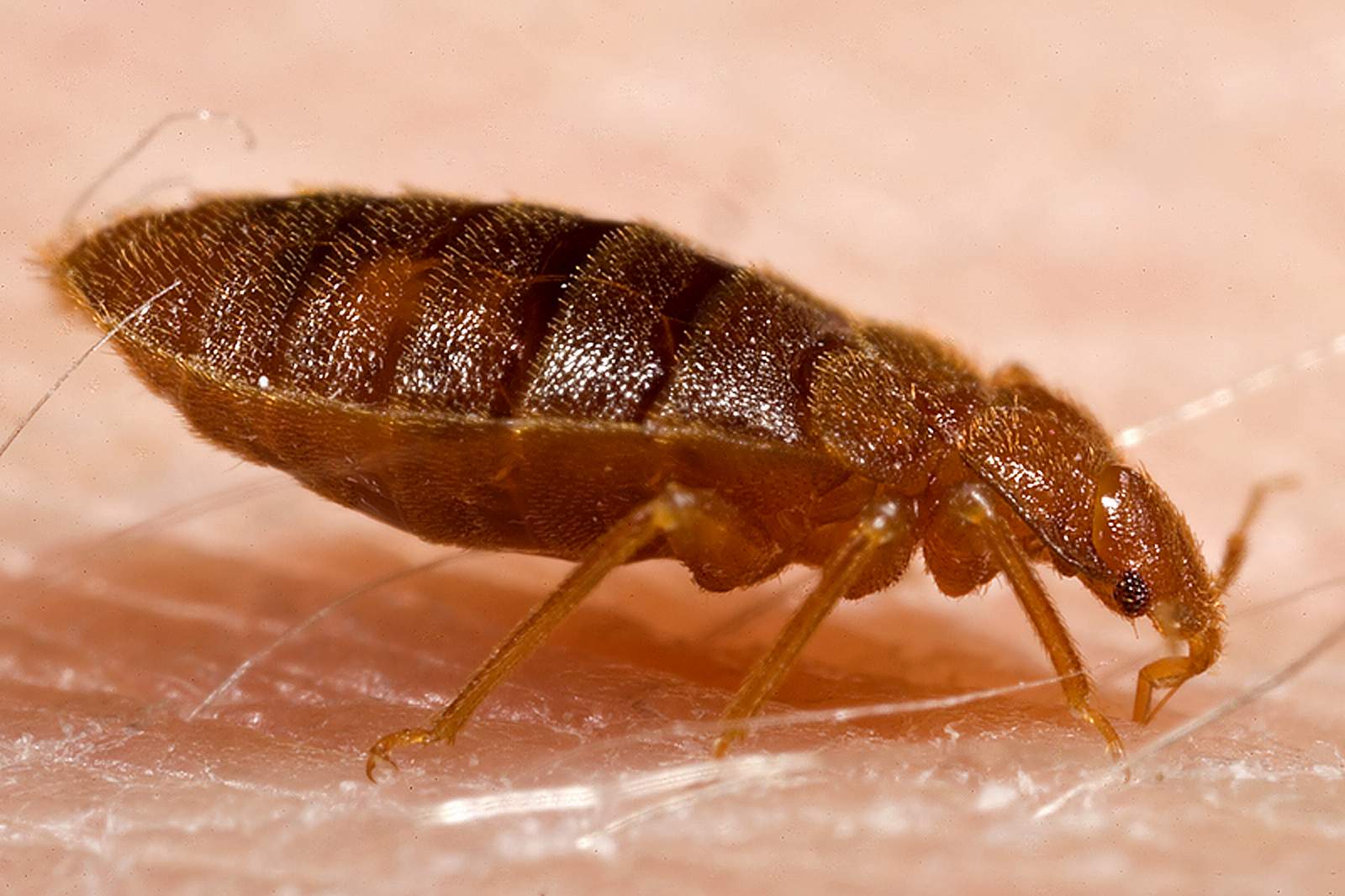 bedbugs bite